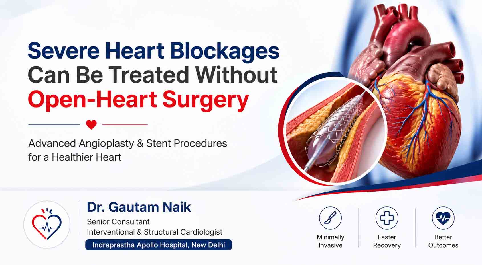 treatment-without-open-heart-surgery